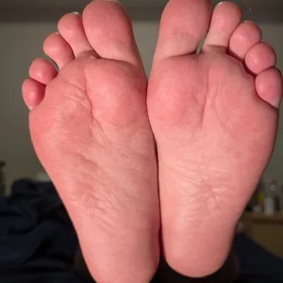 @missiltoes