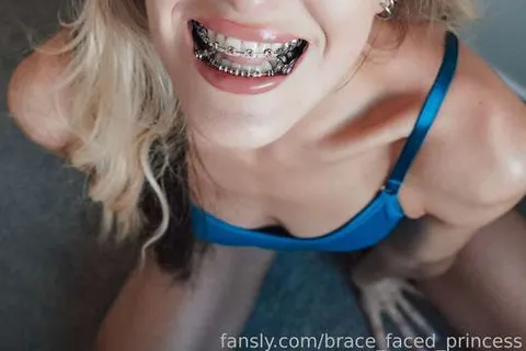 @brace_faced_princess