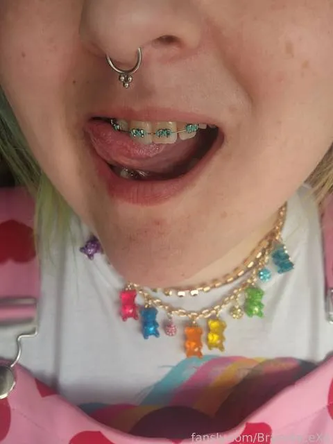 @BracefaceXo