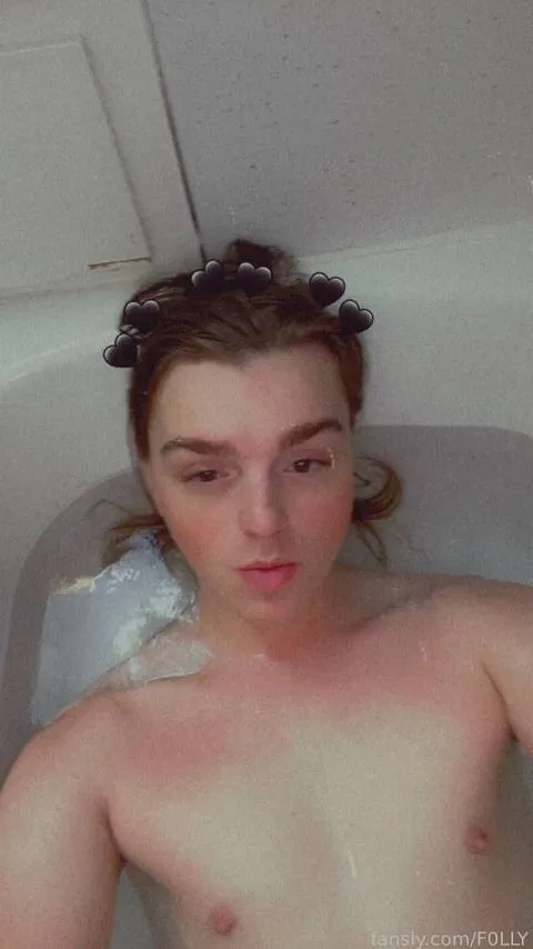 @F0LLY