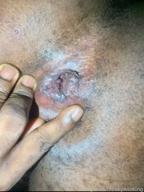 @FreakyAssKing