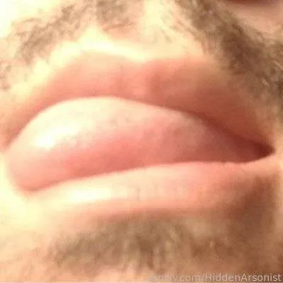 @HiddenArsonist