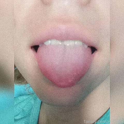 @irisfem