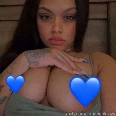 @kandiigokrazy