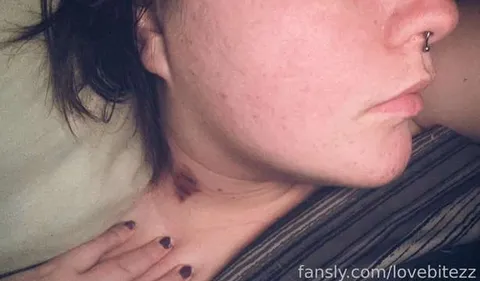 @lovebitezz