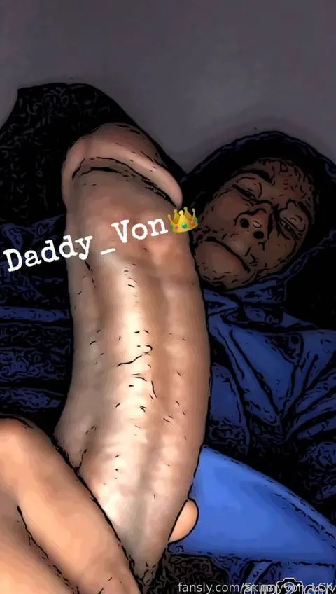 @Skinnyvon_LCK