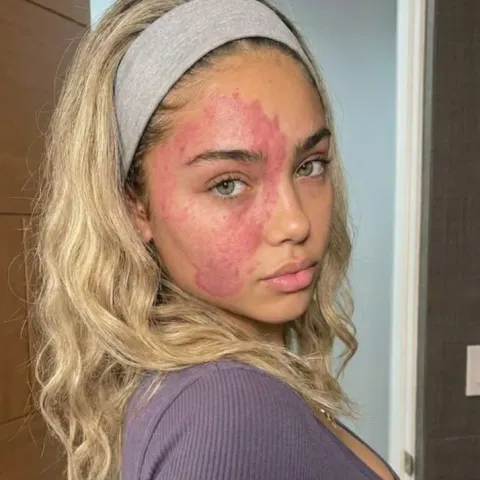 @judy.ash