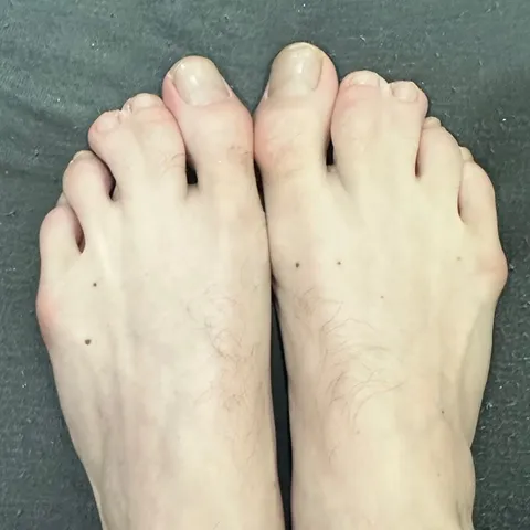 @toeshot