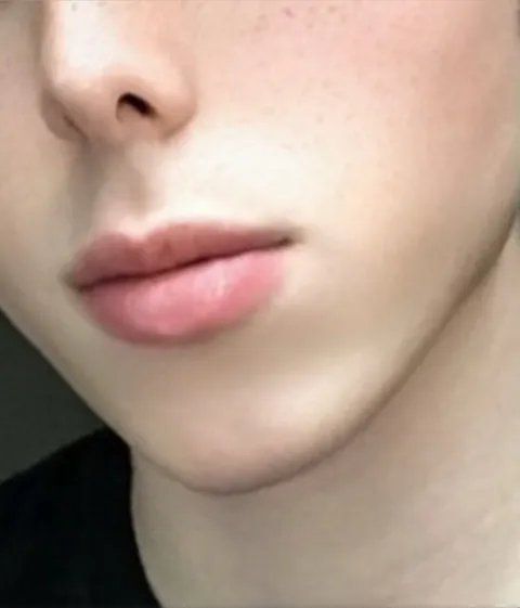@adrianlunelle