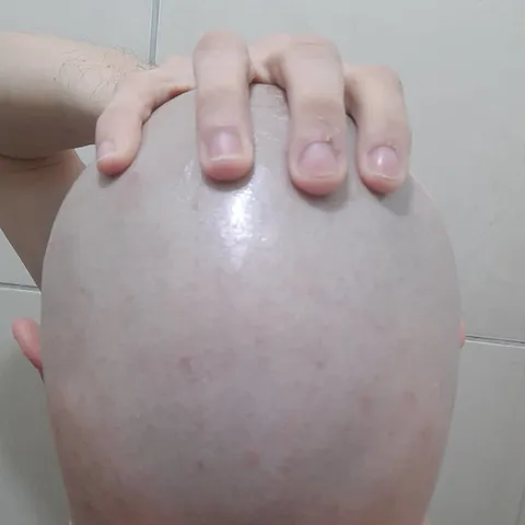 @bald_slave